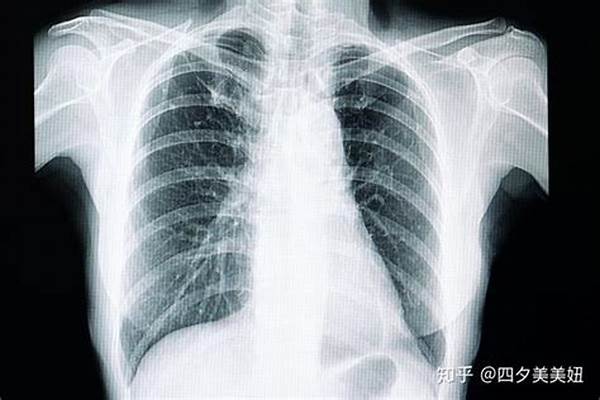 肺部检查都有哪些项目